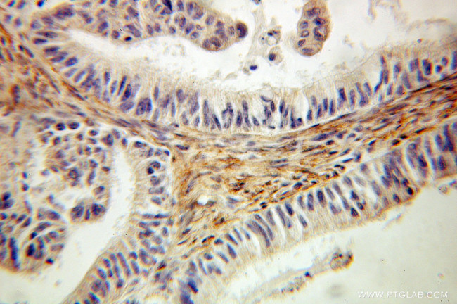 EMILIN1 Antibody in Immunohistochemistry (Paraffin) (IHC (P))