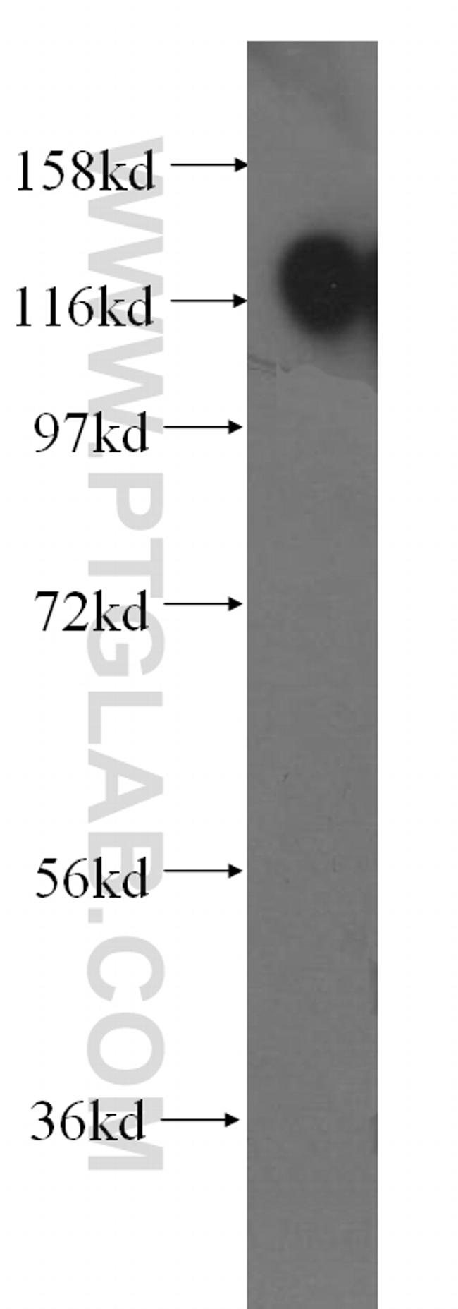 EMILIN1 Antibody in Western Blot (WB)