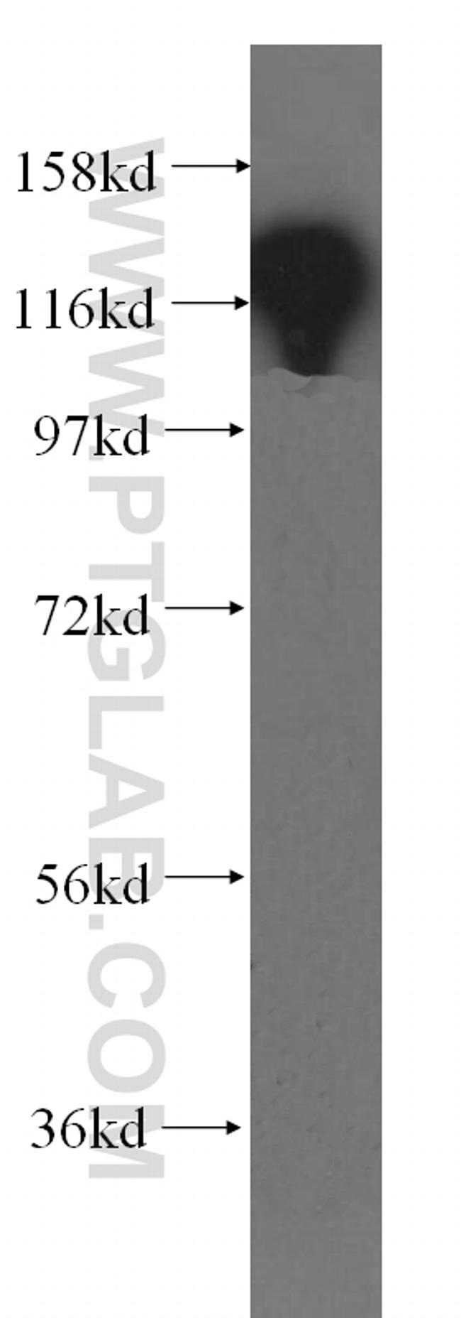 EMILIN1 Antibody in Western Blot (WB)