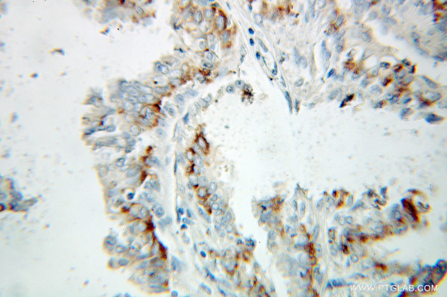 ERAB Antibody in Immunohistochemistry (Paraffin) (IHC (P))