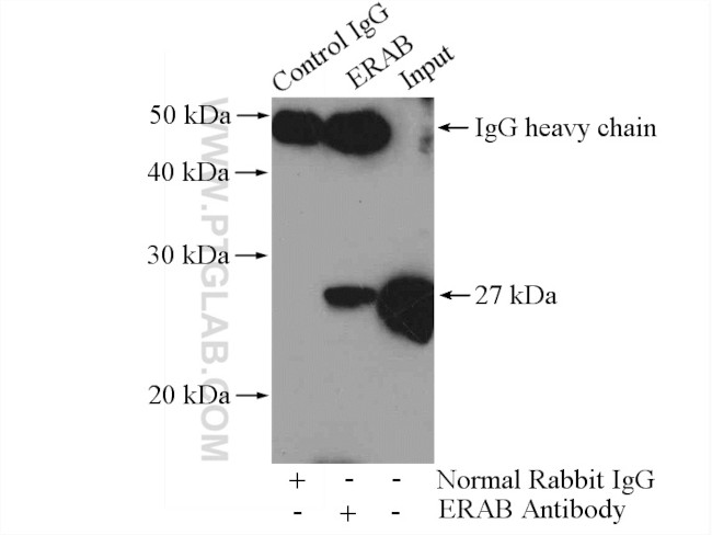 ERAB Antibody in Immunoprecipitation (IP)