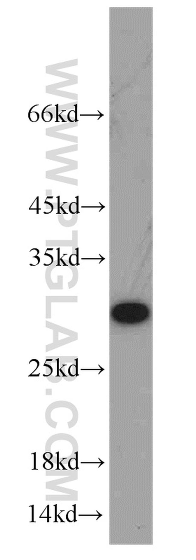 ERAB Antibody in Western Blot (WB)