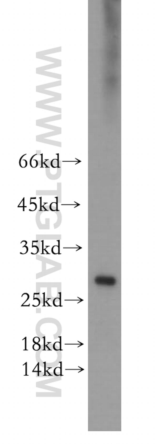 ERAB Antibody in Western Blot (WB)