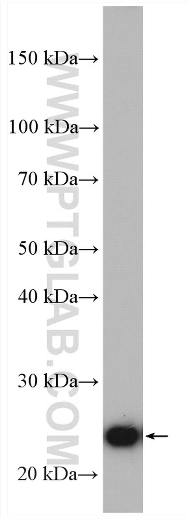 ERAB Antibody in Western Blot (WB)