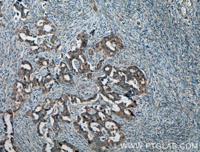 Hsc70 Antibody in Immunohistochemistry (Paraffin) (IHC (P))