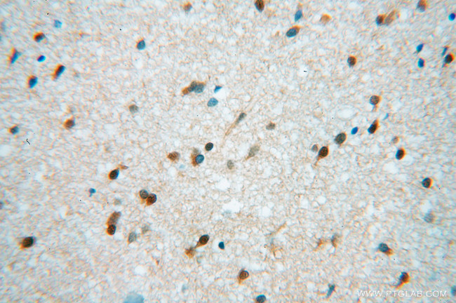 Hsc70 Antibody in Immunohistochemistry (Paraffin) (IHC (P))