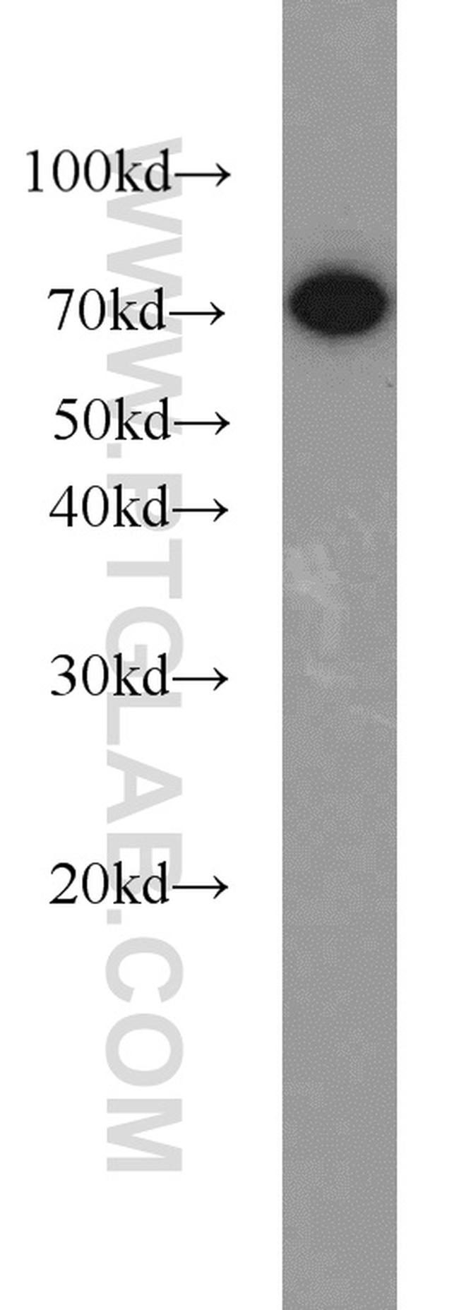 Hsc70 Antibody in Western Blot (WB)