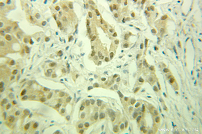 FKBP52 Antibody in Immunohistochemistry (Paraffin) (IHC (P))