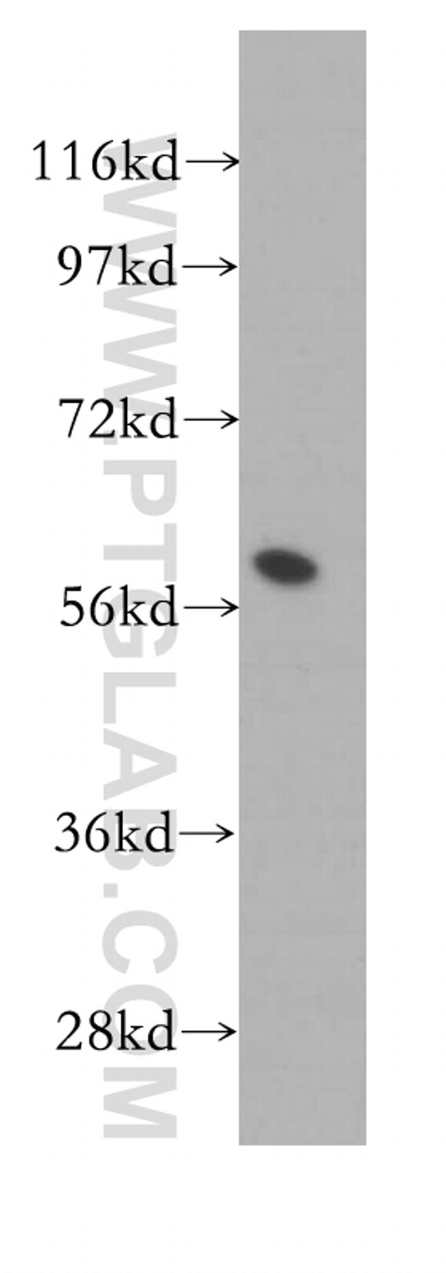 FKBP52 Antibody in Western Blot (WB)