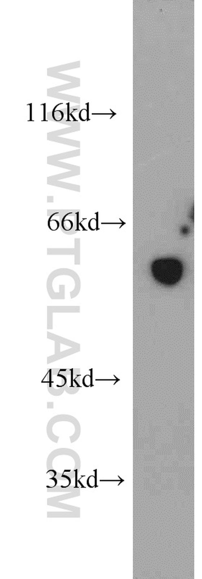 FKBP52 Antibody in Western Blot (WB)