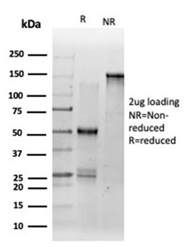 DMRT2 (Transcription Factor) Antibody in Immunoelectrophoresis (IE)