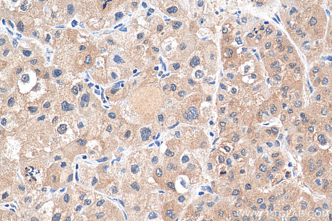 DENR Antibody in Immunohistochemistry (Paraffin) (IHC (P))