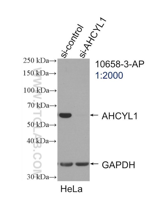 AHCYL1 Antibody in Western Blot (WB)