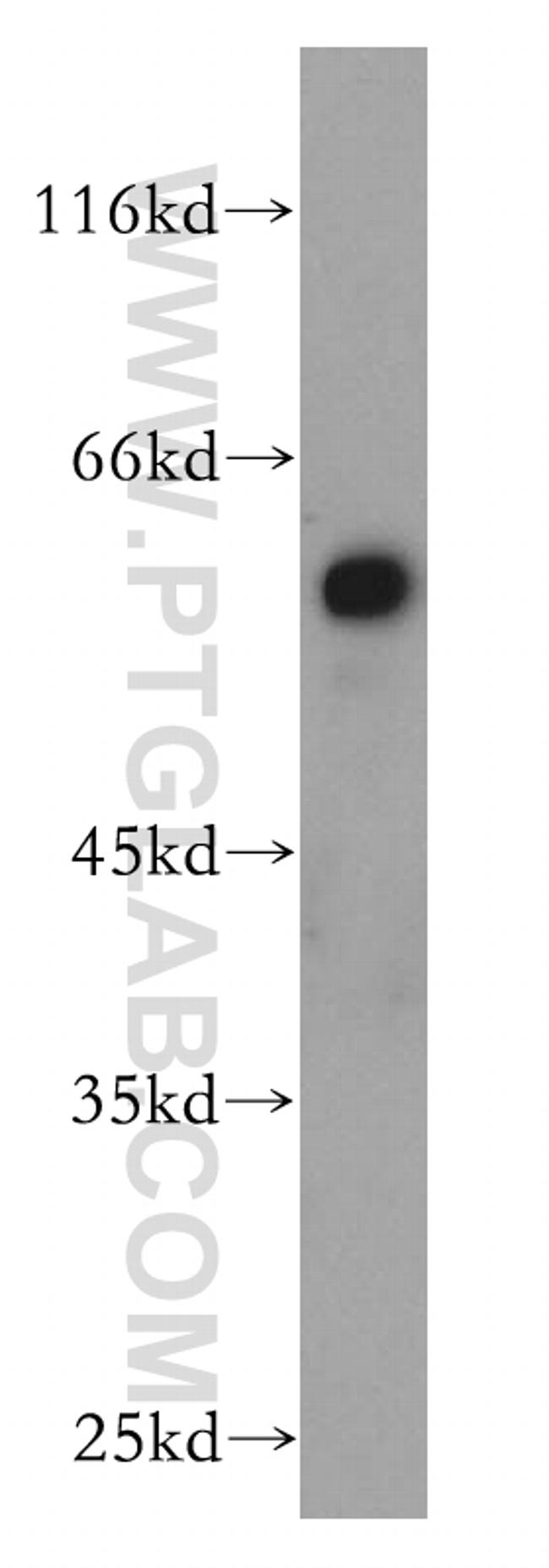 AHCYL1 Antibody in Western Blot (WB)