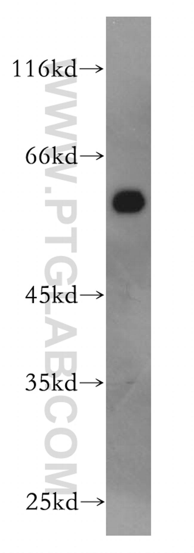 AHCYL1 Antibody in Western Blot (WB)