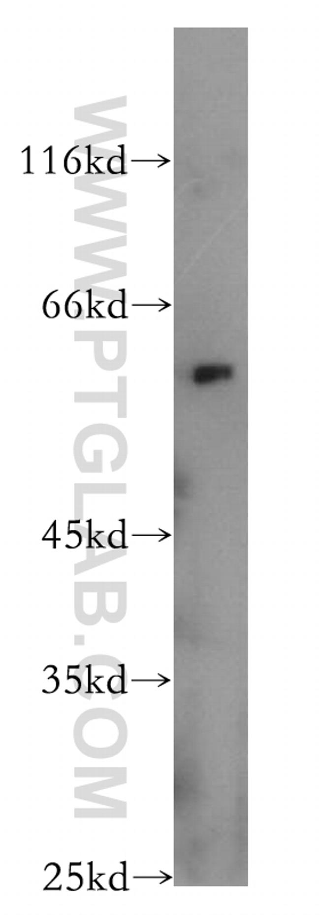 AHCYL1 Antibody in Western Blot (WB)