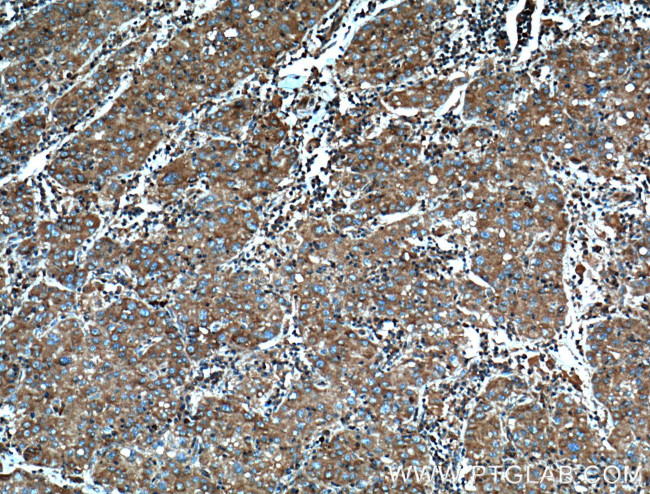 AHCYL1 Antibody in Immunohistochemistry (Paraffin) (IHC (P))