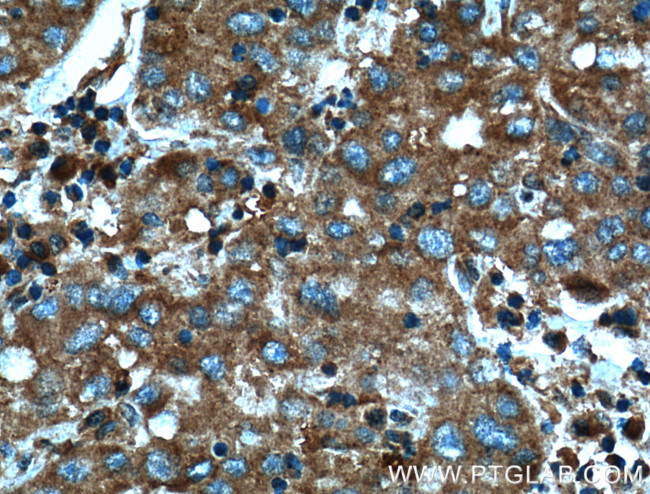 AHCYL1 Antibody in Immunohistochemistry (Paraffin) (IHC (P))