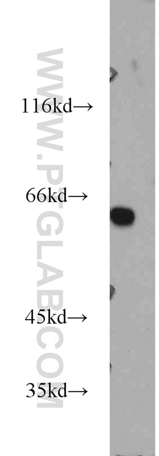 AHCYL1 Antibody in Western Blot (WB)