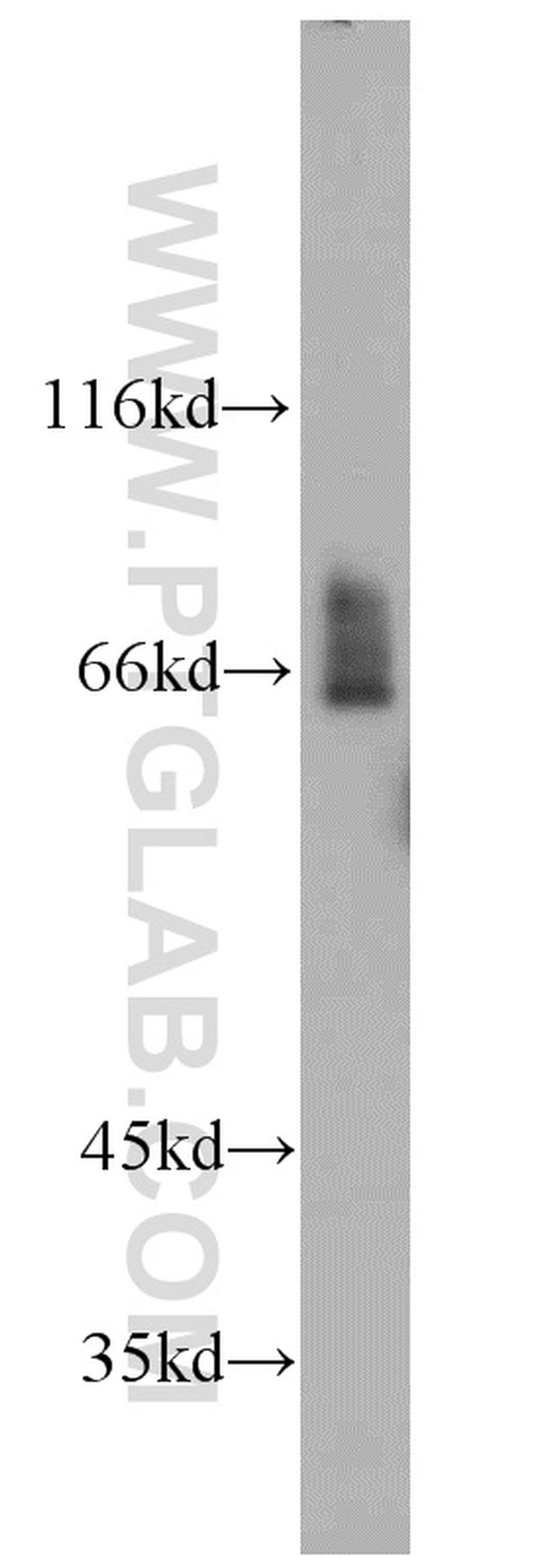 NF2 Antibody in Western Blot (WB)