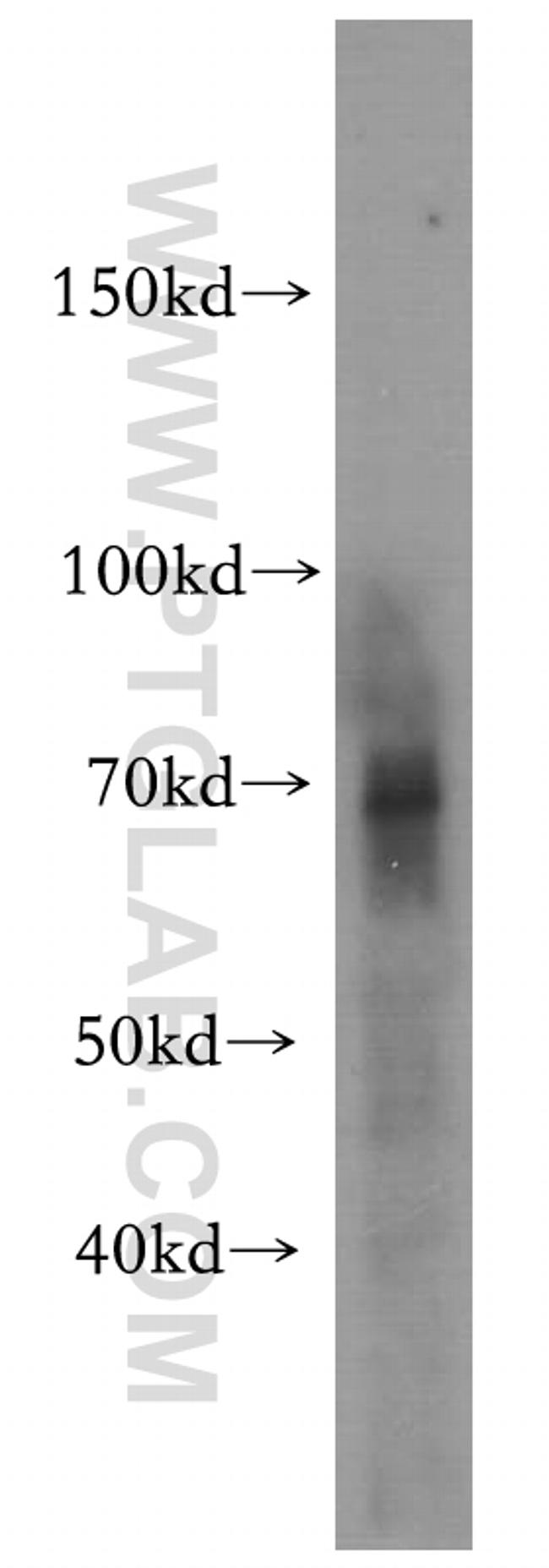 NF2 Antibody in Western Blot (WB)