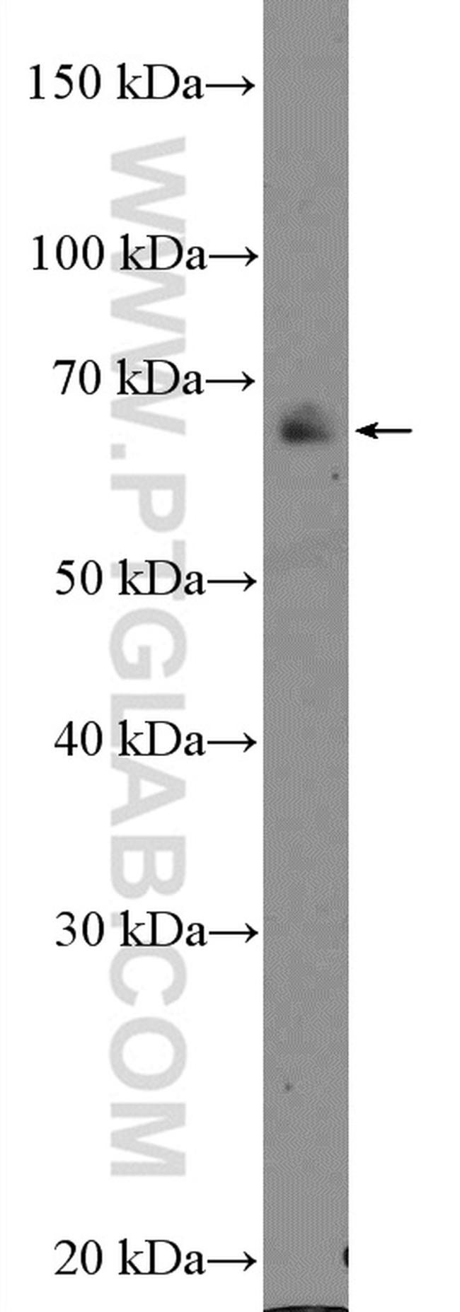 NF2 Antibody in Western Blot (WB)