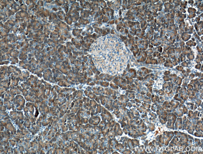 XPNPEP1 Antibody in Immunohistochemistry (Paraffin) (IHC (P))