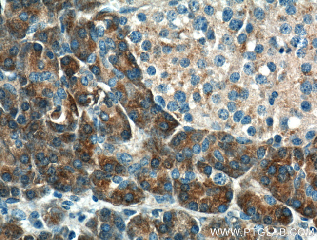 XPNPEP1 Antibody in Immunohistochemistry (Paraffin) (IHC (P))