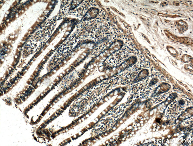 XPNPEP1 Antibody in Immunohistochemistry (Paraffin) (IHC (P))