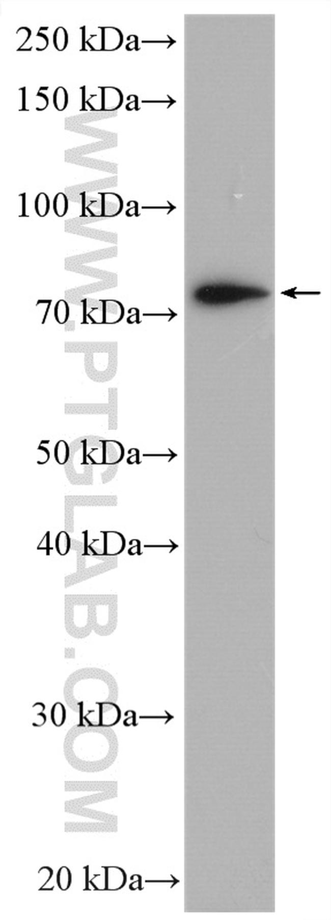 XPNPEP1 Antibody in Western Blot (WB)