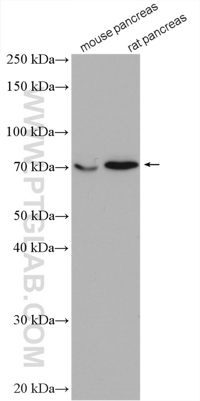 XPNPEP1 Antibody in Western Blot (WB)