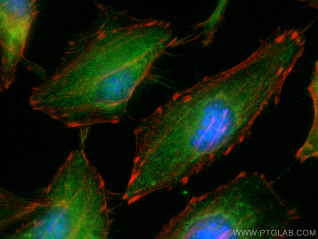 IL18 Antibody in Immunocytochemistry (ICC/IF)