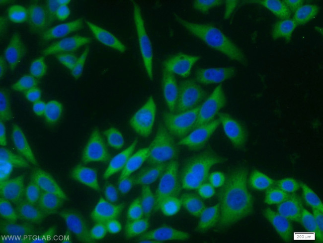 IL18 Antibody in Immunocytochemistry (ICC/IF)