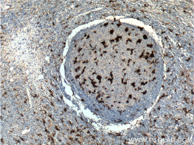 IL18 Antibody in Immunohistochemistry (Paraffin) (IHC (P))