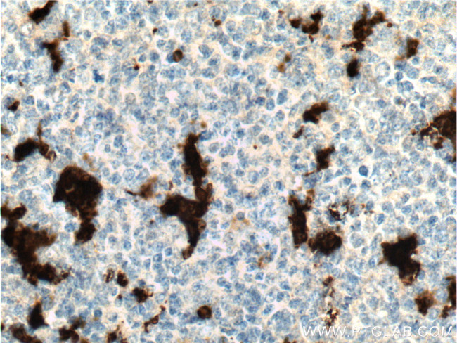 IL18 Antibody in Immunohistochemistry (Paraffin) (IHC (P))