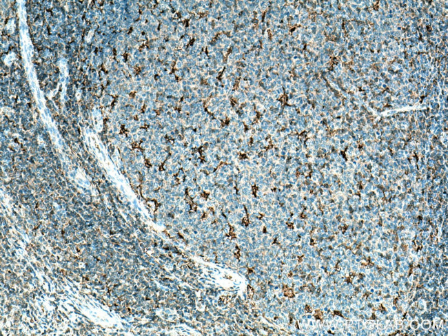 IL18 Antibody in Immunohistochemistry (Paraffin) (IHC (P))