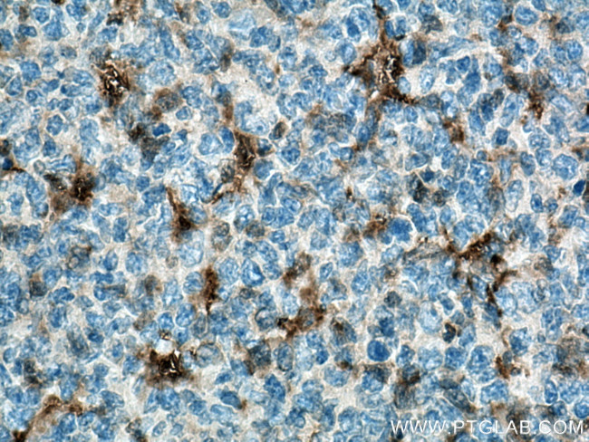 IL18 Antibody in Immunohistochemistry (Paraffin) (IHC (P))