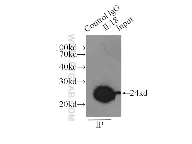 IL18 Antibody in Immunoprecipitation (IP)