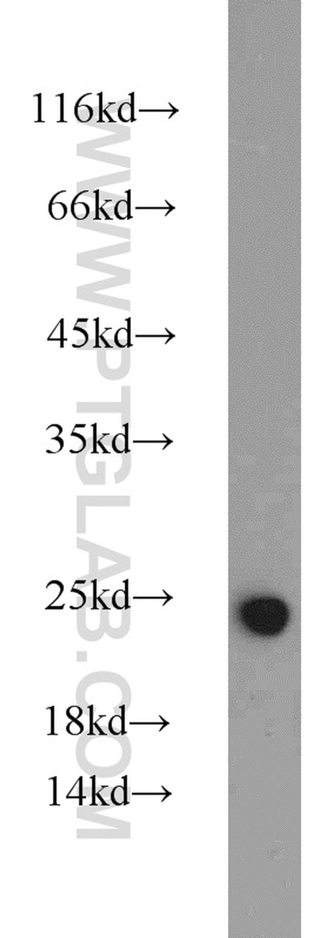 IL18 Antibody in Western Blot (WB)