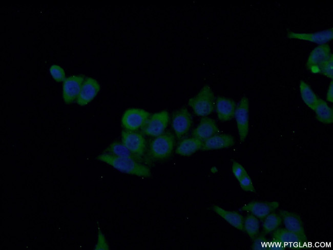 IL18 Antibody in Immunocytochemistry (ICC/IF)