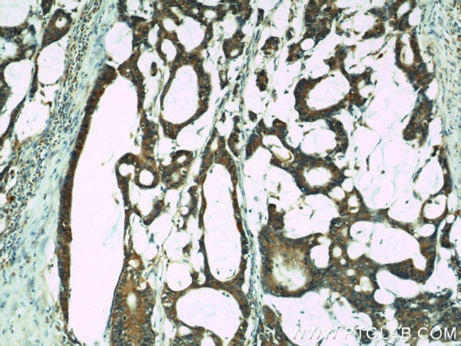 IL18 Antibody in Immunohistochemistry (Paraffin) (IHC (P))