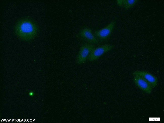 PRDX3 Antibody in Immunocytochemistry (ICC/IF)