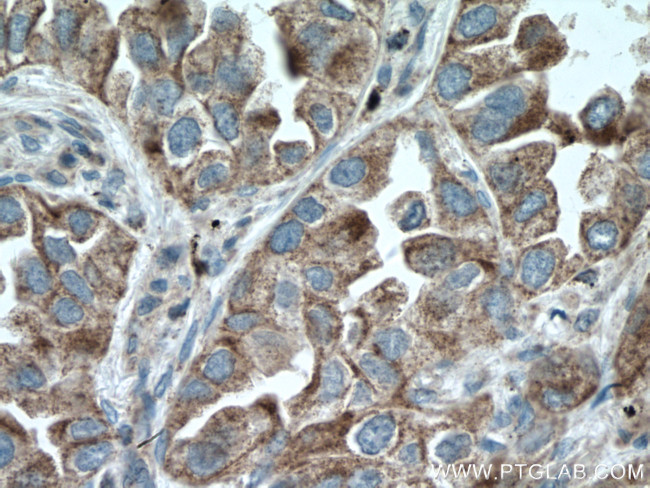 PRDX3 Antibody in Immunohistochemistry (Paraffin) (IHC (P))