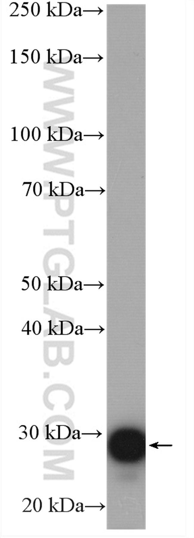 PRDX3 Antibody in Western Blot (WB)