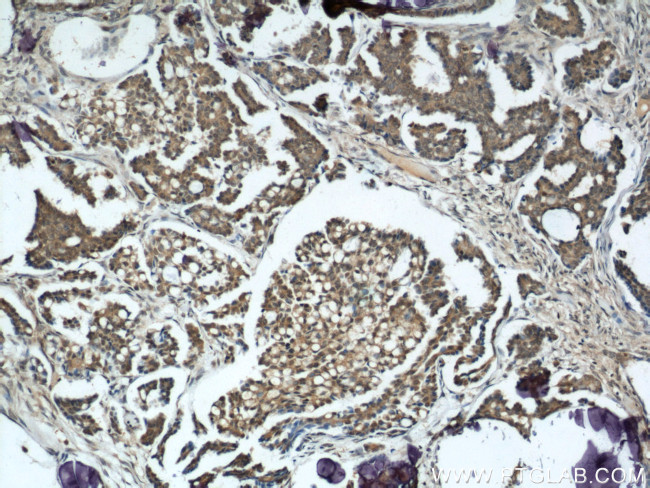 ING5 Antibody in Immunohistochemistry (Paraffin) (IHC (P))