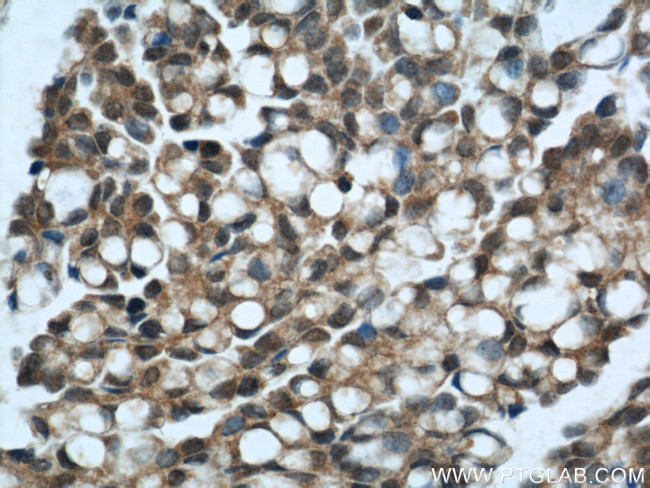 ING5 Antibody in Immunohistochemistry (Paraffin) (IHC (P))