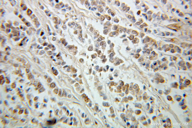 ING5 Antibody in Immunohistochemistry (Paraffin) (IHC (P))