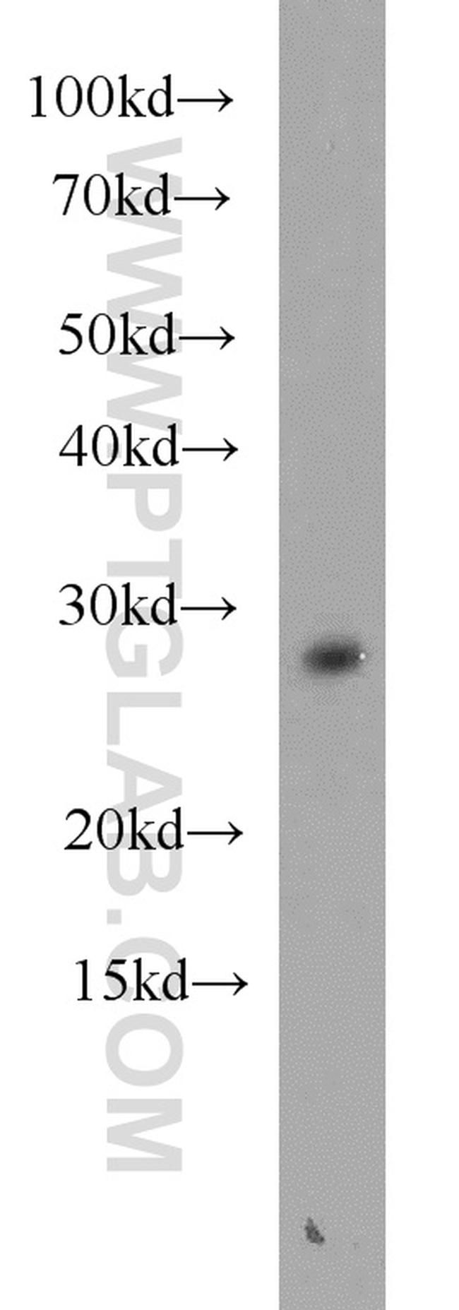 ING5 Antibody in Western Blot (WB)