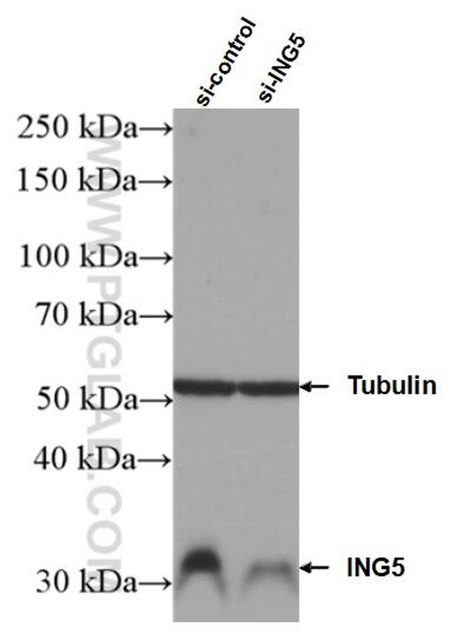 ING5 Antibody in Western Blot (WB)