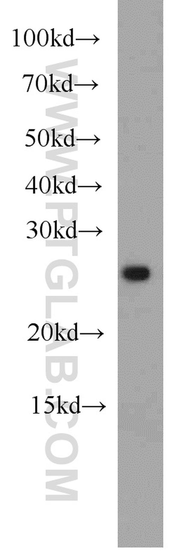 ING5 Antibody in Western Blot (WB)